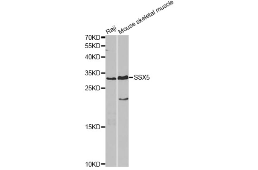 Western Blot - Anti-SSX5 Antibody (A4130) - Antibodies.com