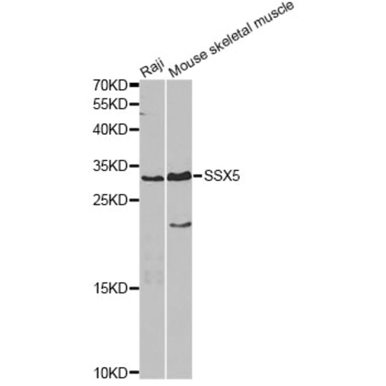 Western Blot - Anti-SSX5 Antibody (A4130) - Antibodies.com