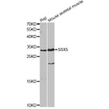 Western Blot - Anti-SSX5 Antibody (A4130) - Antibodies.com