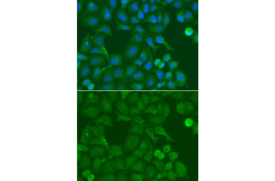 Immunofluorescence - Anti-SSX5 Antibody (A4130) - Antibodies.com