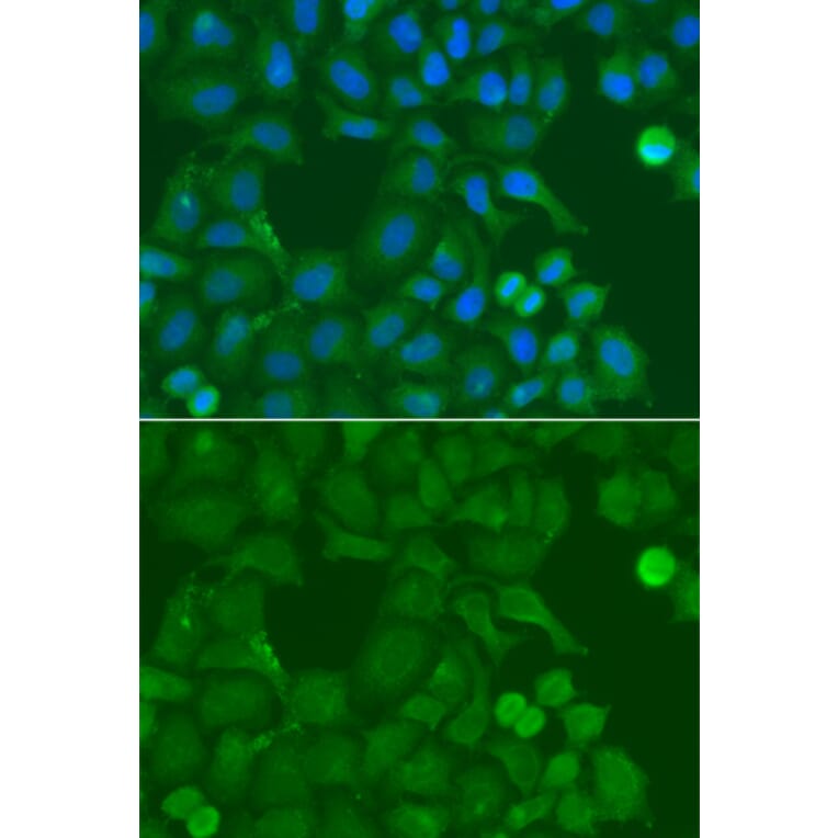 Immunofluorescence - Anti-SSX5 Antibody (A4130) - Antibodies.com