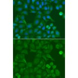 Immunofluorescence - Anti-SSX5 Antibody (A4130) - Antibodies.com