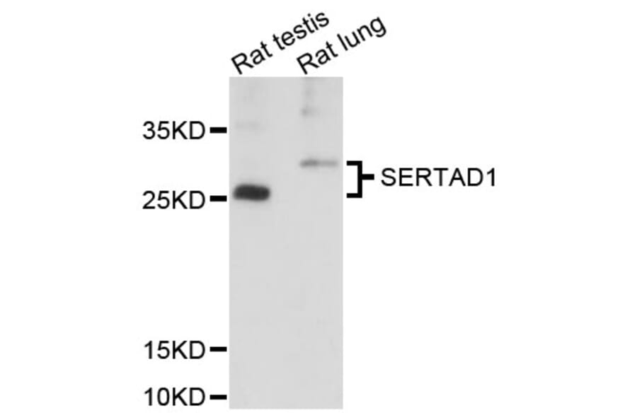 Western Blot - Anti-SERTAD1 Antibody (A8621) - Antibodies.com