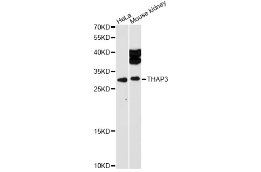 Western Blot - Anti-THAP3 Antibody (A12854) - Antibodies.com
