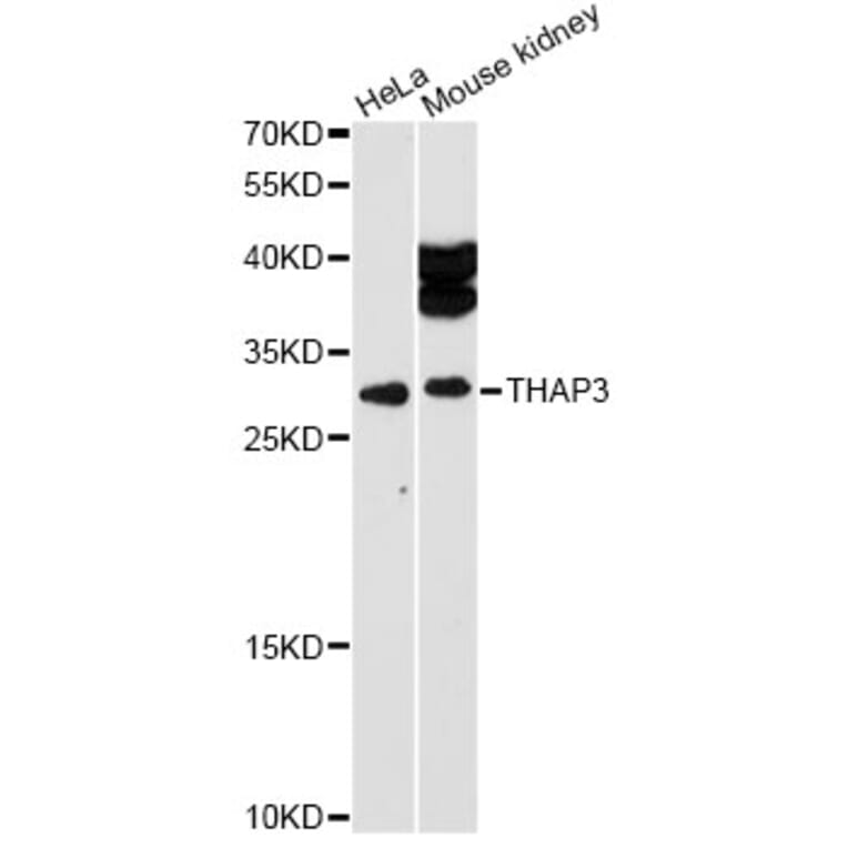 Western Blot - Anti-THAP3 Antibody (A12854) - Antibodies.com