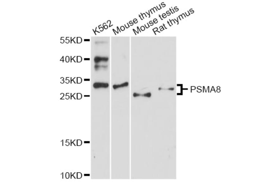 Western Blot - Anti-PSMA8 Antibody (A14365) - Antibodies.com