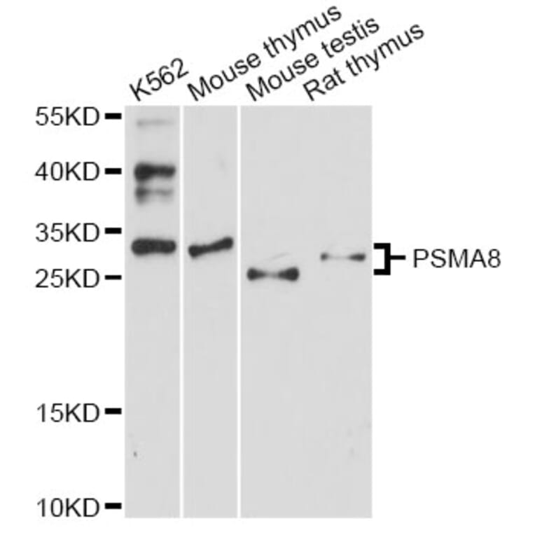 Western Blot - Anti-PSMA8 Antibody (A14365) - Antibodies.com