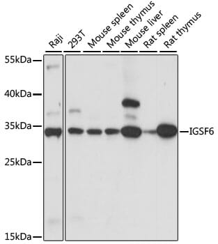 Western blot analysis of extracts of various cell lines, using Anti-IGSF6 Antibody (A15128) at 1:1,000 dilution.
Secondary antibody: Goat Anti-Rabbit IgG (H+L) (HRP) (AS014) at 1:10,000 dilution.
Lysates / proteins: 25µg per lane.
Blocking buffer: 3% non-fat dry milk in TBST.
Detection: ECL Basic Kit (RM00020).
Exposure time: 3s.