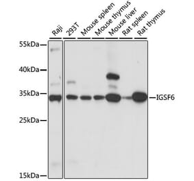 Western Blot - Anti-DORA Antibody (A89164) - Antibodies.com