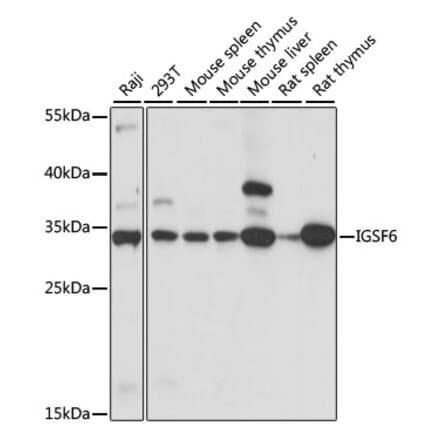 Western Blot - Anti-DORA Antibody (A89164) - Antibodies.com