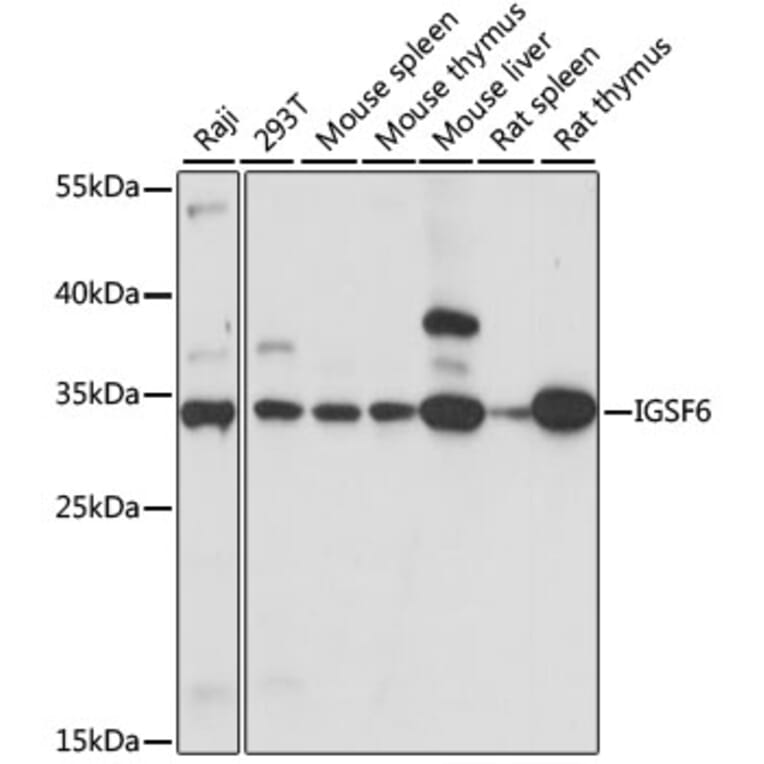 Western Blot - Anti-DORA Antibody (A89164) - Antibodies.com