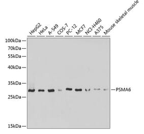 Western Blot - Anti-Proteasome subunit alpha type 6 Antibody (A89165) - Antibodies.com