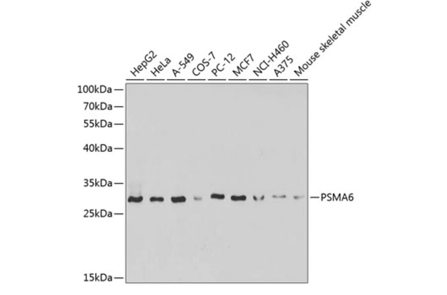 Western Blot - Anti-Proteasome subunit alpha type 6 Antibody (A89165) - Antibodies.com