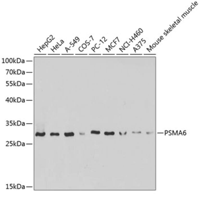 Western Blot - Anti-Proteasome subunit alpha type 6 Antibody (A89165) - Antibodies.com