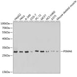 Western Blot - Anti-Proteasome subunit alpha type 6 Antibody (A89165) - Antibodies.com