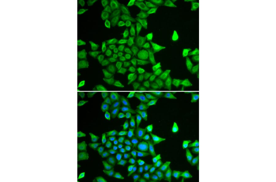 Immunofluorescence - Anti-Proteasome subunit alpha type 6 Antibody (A89165) - Antibodies.com