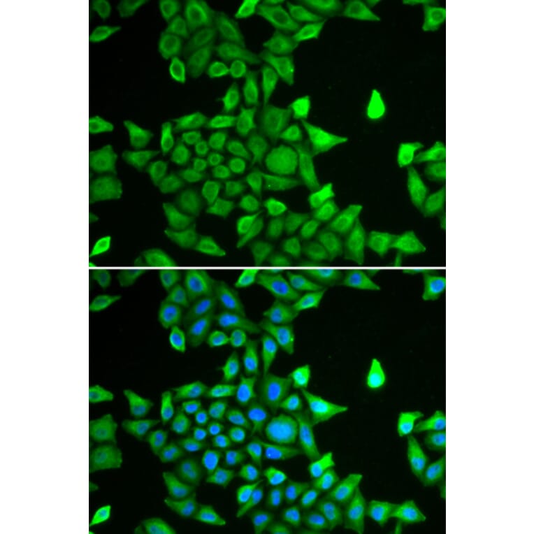 Immunofluorescence - Anti-Proteasome subunit alpha type 6 Antibody (A89165) - Antibodies.com