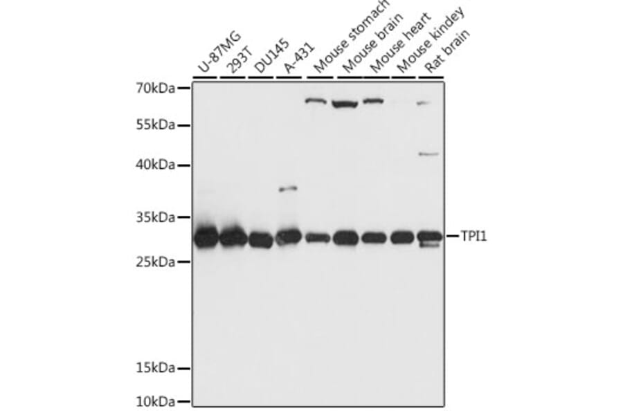 Western Blot - Anti-Triosephosphate isomerase Antibody (A89167) - Antibodies.com