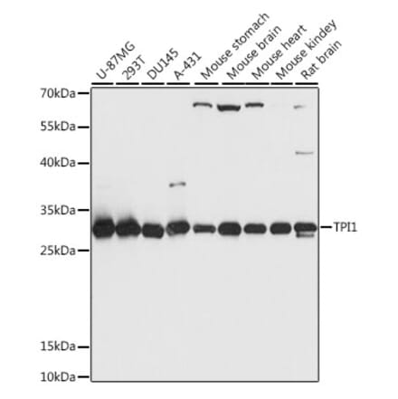 Western Blot - Anti-Triosephosphate isomerase Antibody (A89167) - Antibodies.com