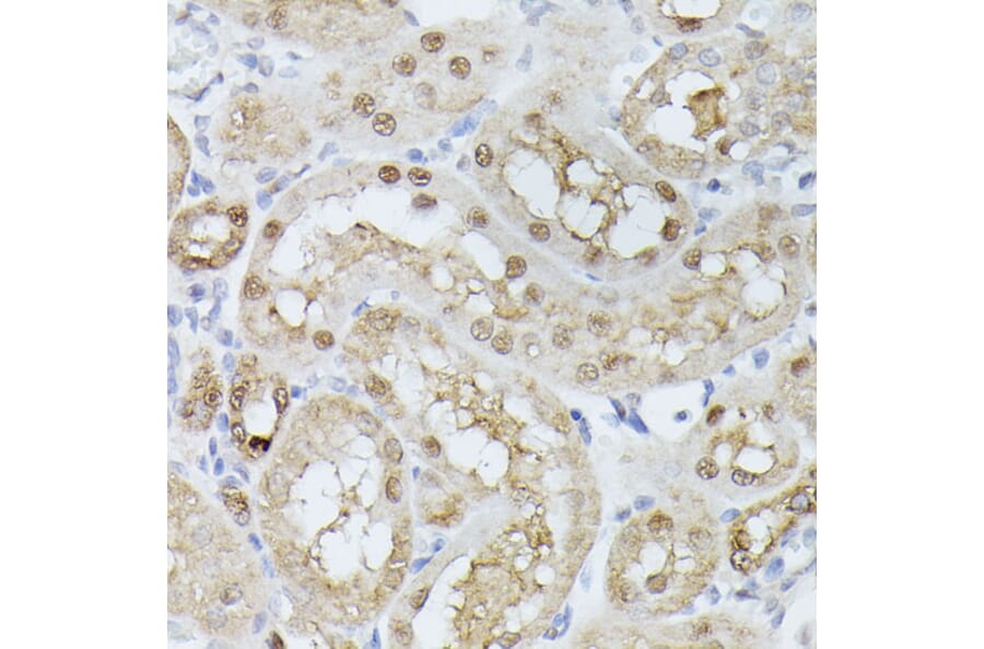 Immunohistochemistry - Anti-Triosephosphate isomerase Antibody (A89167) - Antibodies.com