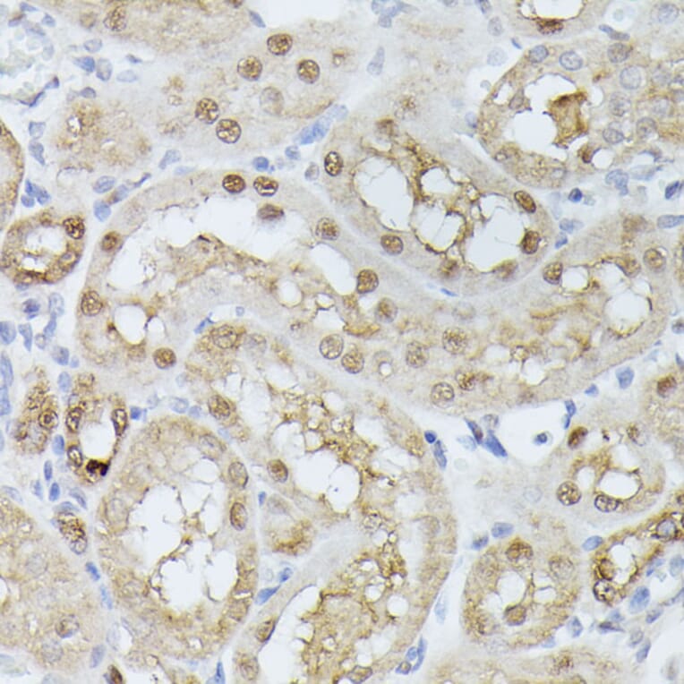 Immunohistochemistry - Anti-Triosephosphate isomerase Antibody (A89167) - Antibodies.com