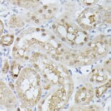 Immunohistochemistry - Anti-Triosephosphate isomerase Antibody (A89167) - Antibodies.com