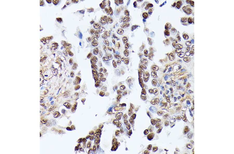 Immunohistochemistry - Anti-Triosephosphate isomerase Antibody (A89167) - Antibodies.com