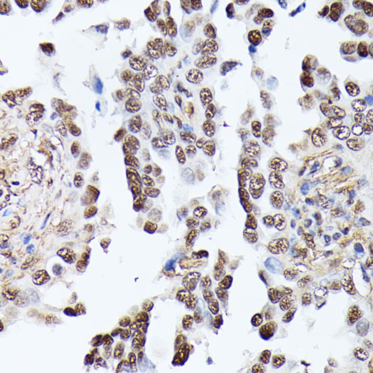 Immunohistochemistry - Anti-Triosephosphate isomerase Antibody (A89167) - Antibodies.com