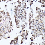 Immunohistochemistry - Anti-Triosephosphate isomerase Antibody (A89167) - Antibodies.com