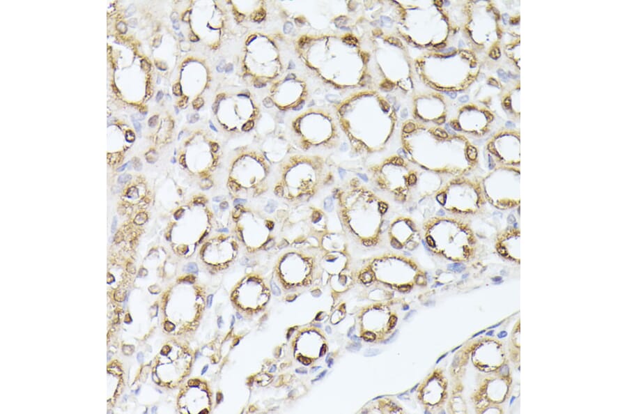 Immunohistochemistry - Anti-Triosephosphate isomerase Antibody (A89167) - Antibodies.com
