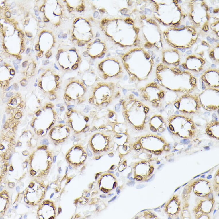 Immunohistochemistry - Anti-Triosephosphate isomerase Antibody (A89167) - Antibodies.com