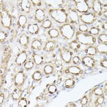 Immunohistochemistry - Anti-Triosephosphate isomerase Antibody (A89167) - Antibodies.com