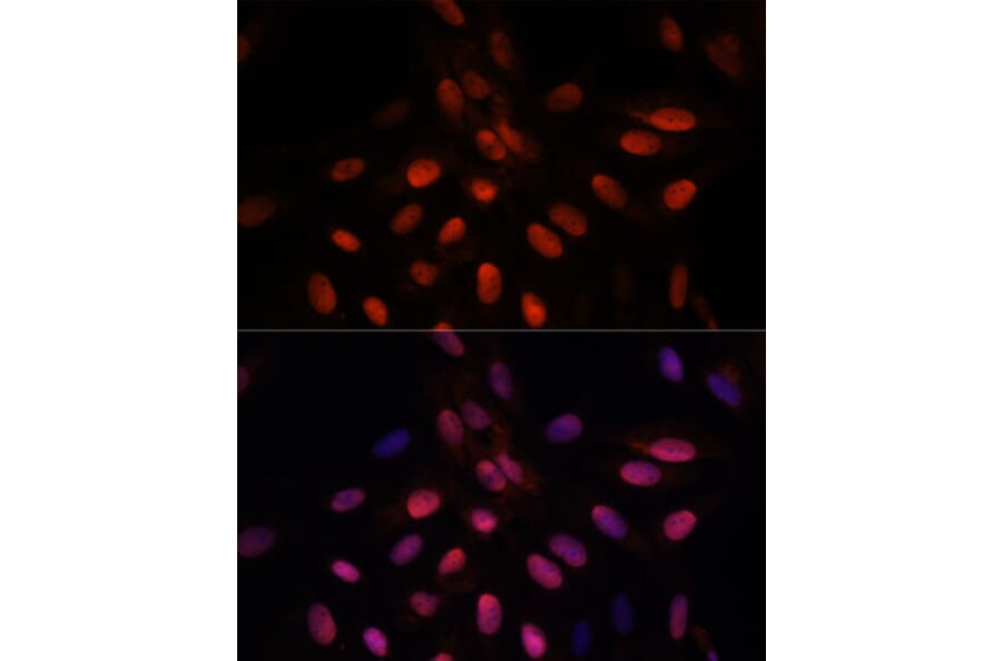 Immunofluorescence - Anti-Triosephosphate isomerase Antibody (A89167) - Antibodies.com