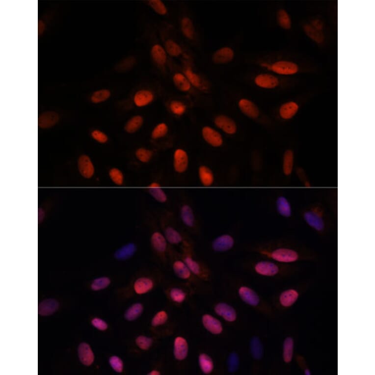 Immunofluorescence - Anti-Triosephosphate isomerase Antibody (A89167) - Antibodies.com