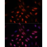 Immunofluorescence - Anti-Triosephosphate isomerase Antibody (A89167) - Antibodies.com