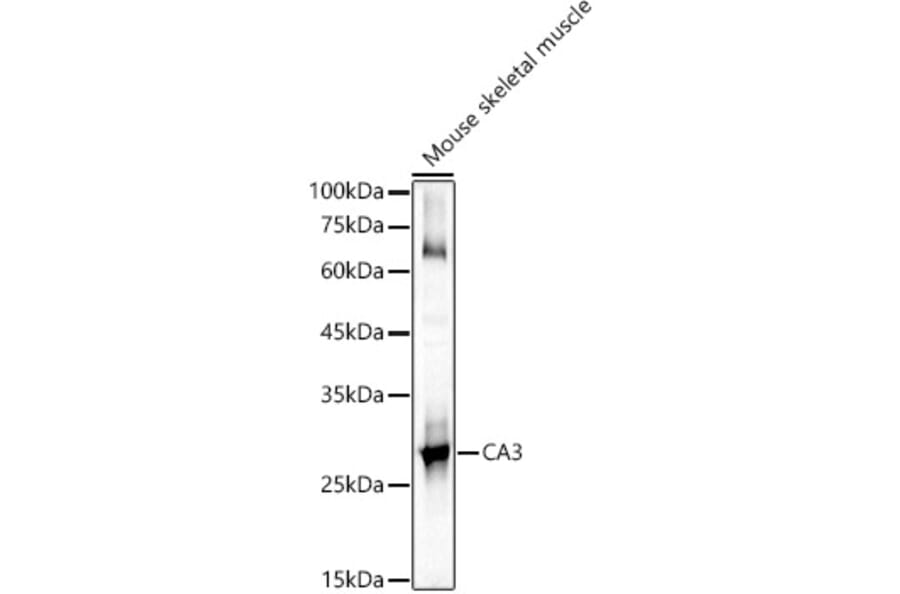 Western Blot - Anti-Carbonic Anhydrase 3/CA3 Antibody (A89168) - Antibodies.com