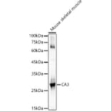 Western Blot - Anti-Carbonic Anhydrase 3/CA3 Antibody (A89168) - Antibodies.com