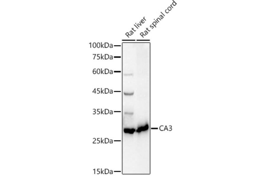 Western Blot - Anti-Carbonic Anhydrase 3/CA3 Antibody (A89168) - Antibodies.com