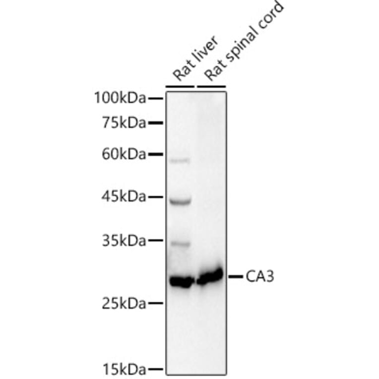 Western Blot - Anti-Carbonic Anhydrase 3/CA3 Antibody (A89168) - Antibodies.com