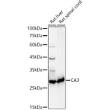 Western Blot - Anti-Carbonic Anhydrase 3/CA3 Antibody (A89168) - Antibodies.com