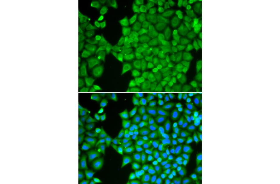 Immunofluorescence - Anti-Carbonic Anhydrase 3/CA3 Antibody (A89168) - Antibodies.com