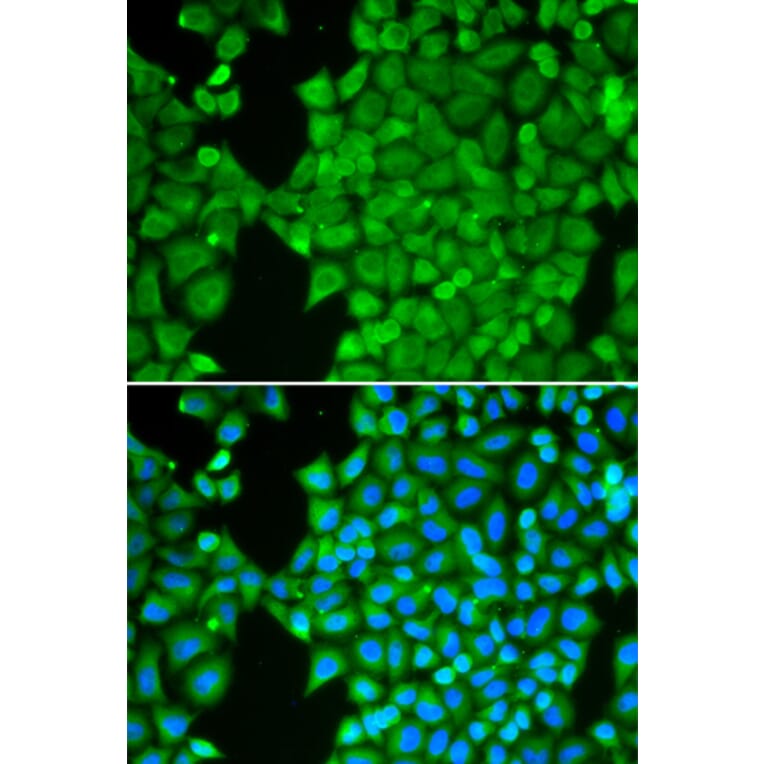 Immunofluorescence - Anti-Carbonic Anhydrase 3/CA3 Antibody (A89168) - Antibodies.com