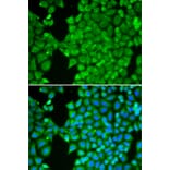 Immunofluorescence - Anti-Carbonic Anhydrase 3/CA3 Antibody (A89168) - Antibodies.com