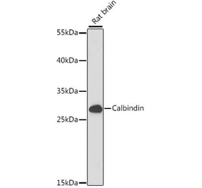 Western Blot - Anti-Calbindin Antibody (A89169) - Antibodies.com