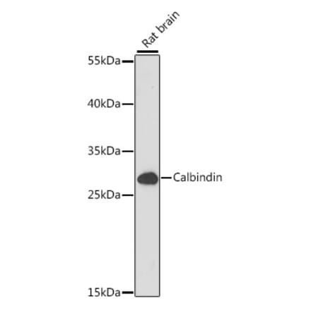 Western Blot - Anti-Calbindin Antibody (A89169) - Antibodies.com
