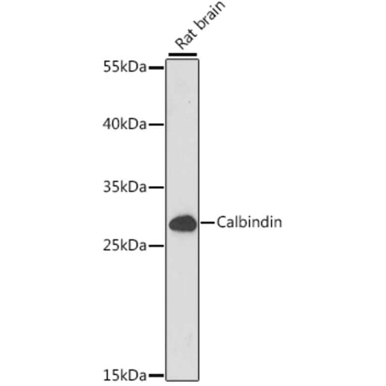 Western Blot - Anti-Calbindin Antibody (A89169) - Antibodies.com