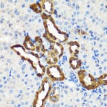 Immunohistochemistry - Anti-Calbindin Antibody (A89169) - Antibodies.com