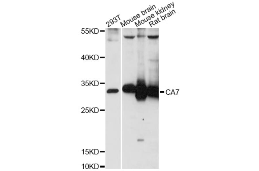 Western Blot - Anti-CA7 Antibody (A14355) - Antibodies.com