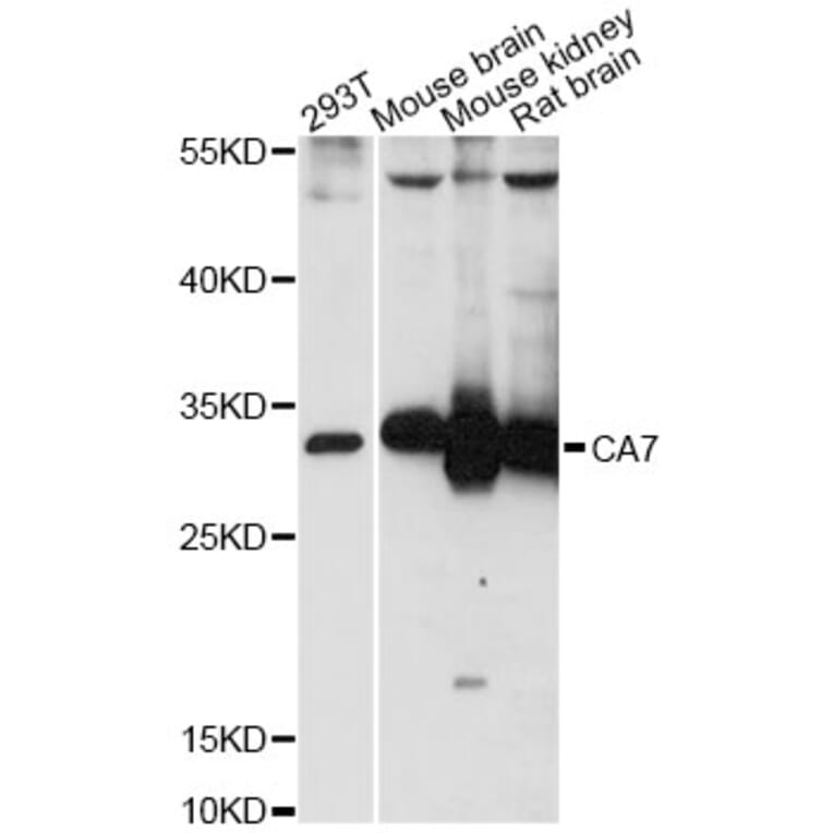 Western Blot - Anti-CA7 Antibody (A14355) - Antibodies.com