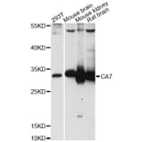 Western Blot - Anti-CA7 Antibody (A14355) - Antibodies.com